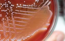 Percutaneous Mechanical Aspiration Promising for Right-Heart Infective Endocarditis